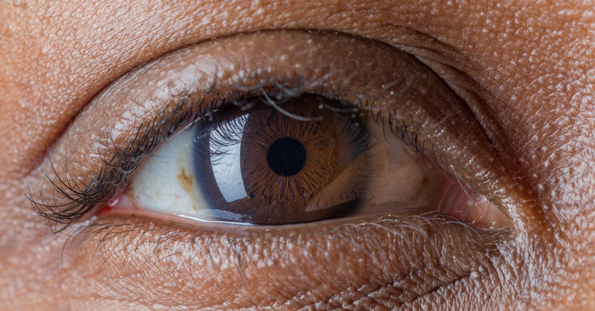 découvrez les mutuelles santé : des solutions adaptées pour protéger votre santé et celle de votre famille, tout en bénéficiant d'un remboursement optimal de vos frais médicaux. informez-vous sur les différentes options et trouvez la couverture qui vous convient.